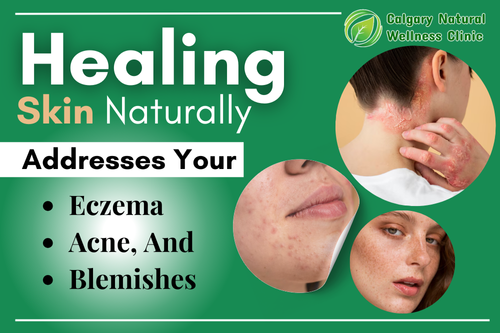 Healing Skin Naturally and Addresses Eczema, Acne, And Blemishes